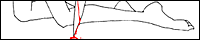 IMG_000383.gif ( 2 KB )